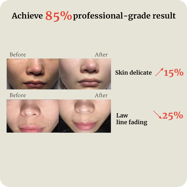 DJM Handheld RF generator