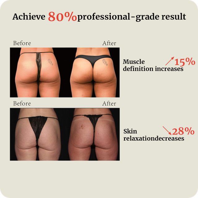 DJM Fascia Shaping Device