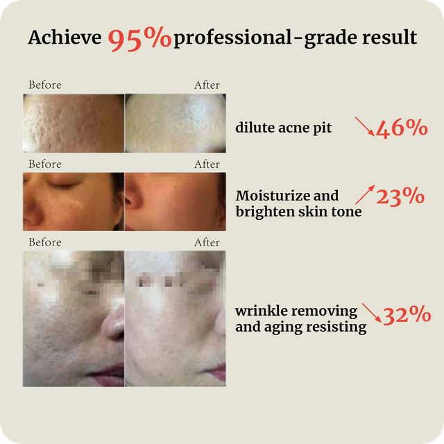 DJM Electric Microneedle